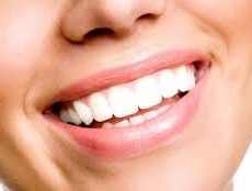 Tout savoir sur le blanchiment des dents Tout savoir sur le blanchiment des dents