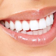 Blanchiment des Dents, Ce qu’il faut Savoir Blanchiment des Dents, Ce qu’il faut Savoir