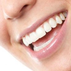 Hypoplasie de l’émail dentaire : quelles sont les solutions ? Hypoplasie de l’émail dentaire : quelles sont les solutions ?
