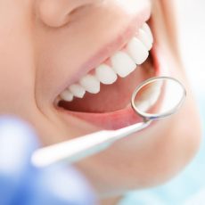 En quoi consiste un blanchiment dentaire ? En quoi consiste un blanchiment dentaire ?