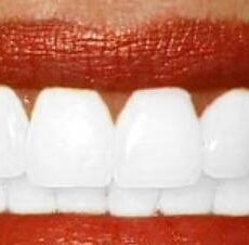 Des dents plus blanches grâce au régime blanc Des dents plus blanches grâce au régime blanc