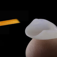 Facette veneers Turquie Facette veneers Turquie