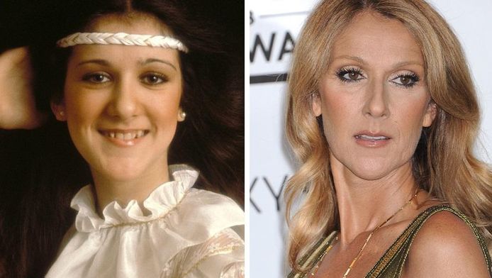 celine dion et chirurgie dentaire