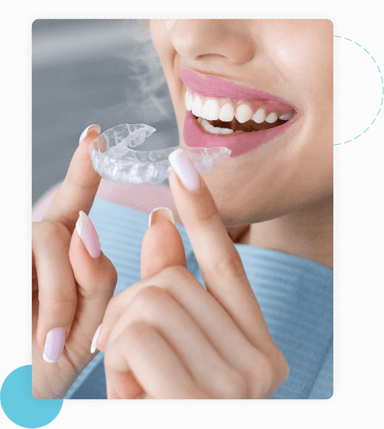 invisalign-en-entier